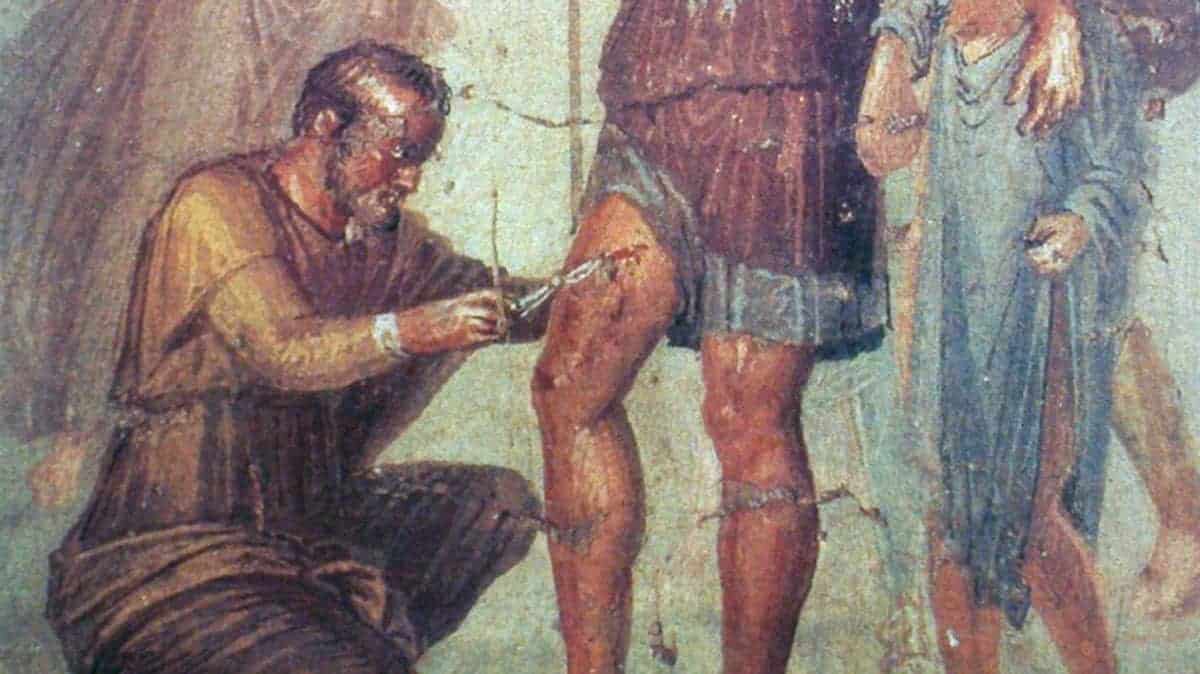 La medicina nell'Antica Roma, La medicina nell&#8217;Antica Roma, Rome Guides
